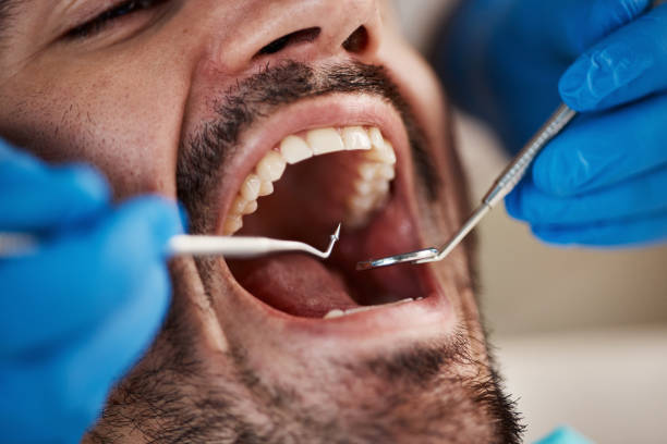 Emergency Dental Services in Hohenwald, TN